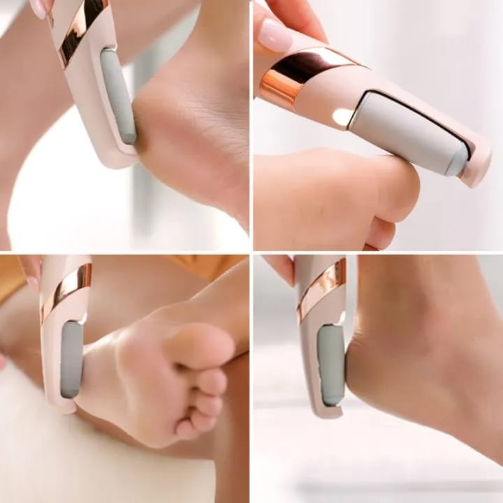 Upgrade Your Foot Care Routine with This Electric Foot Grinder Pedicure Machine - USB Charging, Automatic, Portable & More!